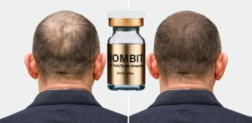 thuoc-moc-toc-bombit-hsc-hair-scalp-ampoule-co-tot-khong-su-that-dang-sau4